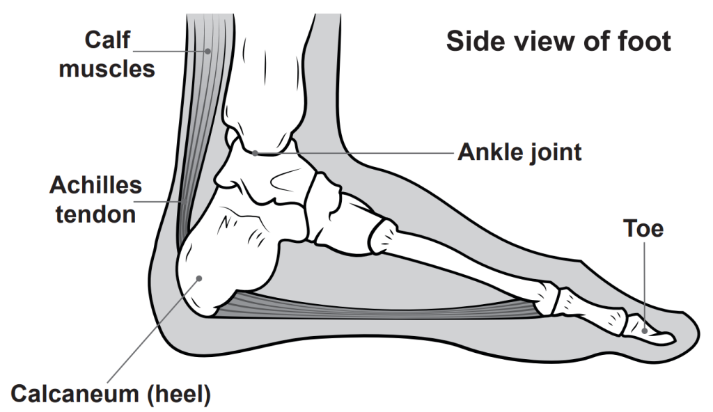 Achilles Tendinopathy NHS Inform