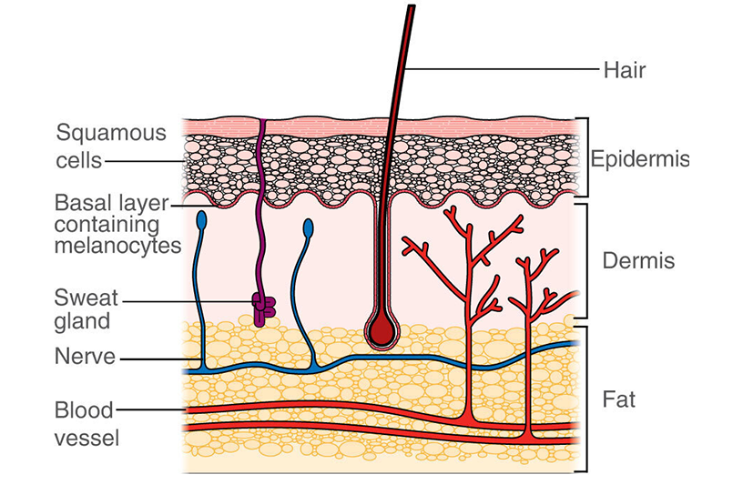 melanotic sarcoma is a skin cancer that begins with quizlet Skin cancer